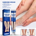thumbnail image 4 of Crema para venas varicosas, 20g, crema de masaje de plantas naturales para eliminar varices y arañas vasculares, mejora la circulación sanguínea, 4 of 8