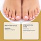 thumbnail image 3 of 1-6pcs XIMONTH Bee Venom Fungus Remover Spray 20ml Nail Soothing Spray for Fragile, Damaged Nails, 3 of 5