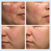 FIRST AID BEAUTY Ultra Repair Cream - 1 Fl oz