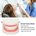 thumbnail image 3 of Modelo De Dientes Dentales, Modelo De Diente De Caries De Resina Para Clínica Para Estudiantes, 3 of 7