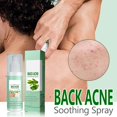 thumbnail image 4 of Skin Care Products Spray Fade Cleanse Back Moisturize And Smooth Skin Hydrating And Calming For Post Breakout Care ！120ml, 4 of 8