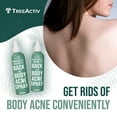 thumbnail image 3 of TreeActiv Salicylic Acid Back & Body Acne Spray, Fine Mist Back Spray for Bacne & Chest Acne, Tea Tree + Eucalyptus, Fast-Drying Non-Staining, 4 fl oz (2-Pack, 8 fl oz Total), 3 of 12