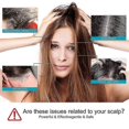 thumbnail image 4 of Seborrheic Dermatitis Psoriasis Shampoo-Scalp Treatment for Folliculitis Psoriasis Dry Itchy Scalp Oily Hair 100ml Psoriasis Shampoo, 4 of 5