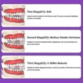 thumbnail image 4 of Teeth straightener, dental braces orthodontic teeth trainer set for adults, alignment 3 stage tooth retainers, 4 of 5