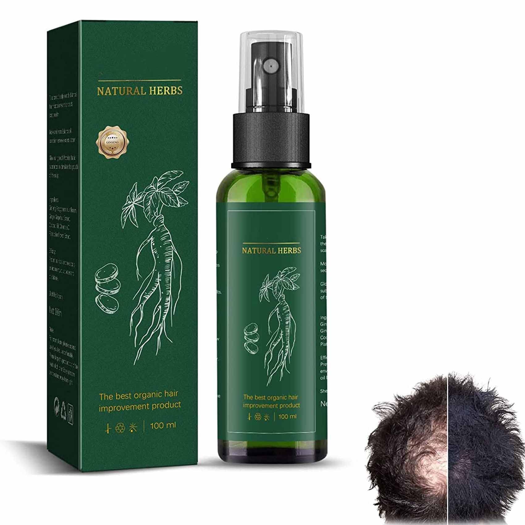 Red Ginseng Hair Regeneration Spray,Ginseng Hair Regrowth Serum Spray
