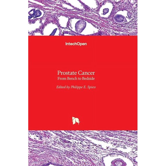 Prostate Cancer: From Bench to Bedside (Hardcover)