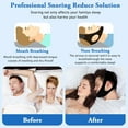 thumbnail image 2 of 2-Pack Snoring Stopper Chin Strap for Sleeping, Jaw Support for Mouth Breathing, Anti Snore Device to Keep Mouth Closed for Men and Women, 2 of 6