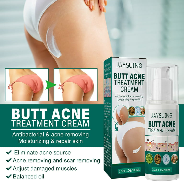 Butt Acne Causes & Treatment (The Cheeky Facts) – SLMD Skincare by