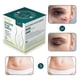 thumbnail image 1 of Silicone Plasters For Scars, Silicone Scar Films For Surgeries, Caesarean Section, Keloids, Burns,silicone Scar Tape-4cm*3m, 1 of 3