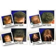 thumbnail image 5 of Toppik Hair Building Fibers, Medium Brown, 0.42 oz 3 Pack, 5 of 7