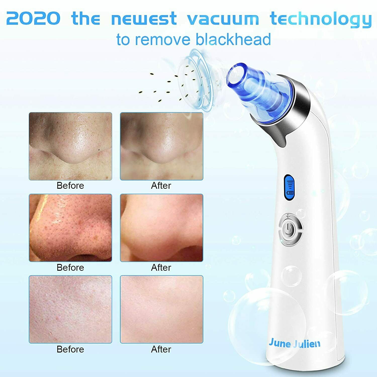 June julien cheap blackhead remover