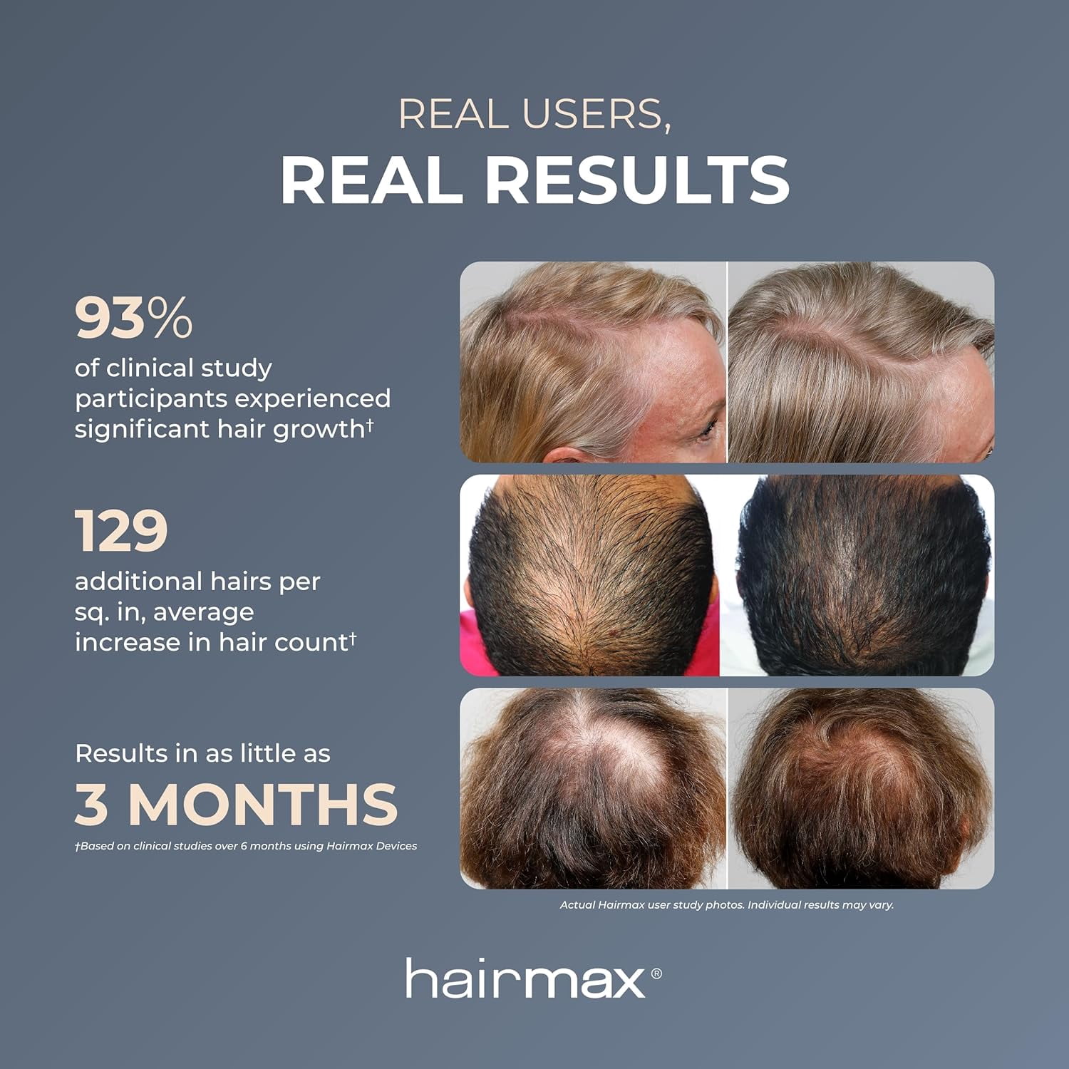 Hairmax PowerFlex 272 Laser Cap - (FDA Cleared) Thinning Hair Loss Solution for Men & Women - Flexible Cordless Design With 7 Minute Treatment Time - Red Light Therapy to Stimulate Hair Growth