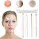 thumbnail image 2 of Kit de agujas para el acné Limpiador de poros removedor de espinillas de acero inoxidable (oro rosa) Tmvgtek cuidado belleza, 2 of 9