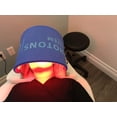 thumbnail image 4 of Máquina fotodinámica para el cuidado de la piel facial con luz LED PDT, 4 of 7