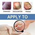 thumbnail image 4 of Healio Nail Treatment Gel ,foot Care Gel Anti Infection Thicken Soft Nails, 4 of 5