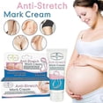 thumbnail image 1 of Anti-stretch Mark Repair Cream For Pregnancy Scar Slack Line Stretch Skin Mark Remover Body Lotion, 1 of 5