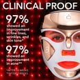 thumbnail image 2 of Mascarilla LED Dr. Dennis Gross DRx SpectraLite FaceWare Pro, 2 of 9