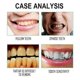 thumbnail image 3 of 2025 Latest Model Floss Picks, Teeth Cleaning Interdental Disposable Household Portable Floss Stick, 3 of 5