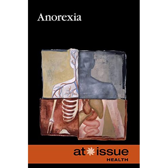 Pre-Owned Anorexia (At Issue), 9780737748673, 0737748672, Paperback, 2 edition