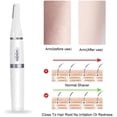 thumbnail image 5 of Nose Hair Trimmer/Ear Hair Trimmer for Eyebrow Shaver, Portable Professional Painless Hair Trimmer, 5 of 5