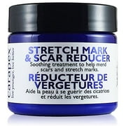 Carapex Stretch Mark & Scar Reducer Cream - 98% Natural
