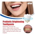 thumbnail image 4 of Sp-6 Dental Blanqueator, Blue 120g*2, Dental Cleaning, 4 of 8