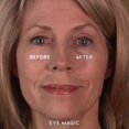 Eye Magic Premium Instant Eye Lift (L/XL) Lifts a Droopy, Sagging