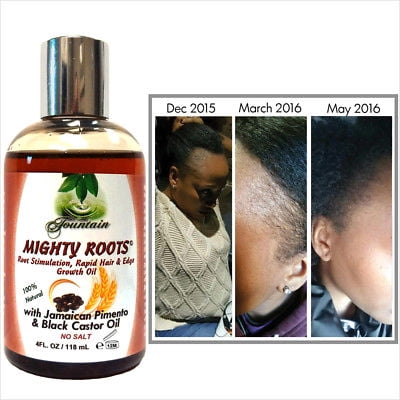 Fountain receding hairline or thin hair growth oil /Jamaican pimento black castor oil (Best Product For Thinning Hair Female)