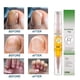 thumbnail image 2 of Pluma De Tratamiento De Uñas 5ml 1 ANGGREK Nail Fungal Pen, 2 of 7