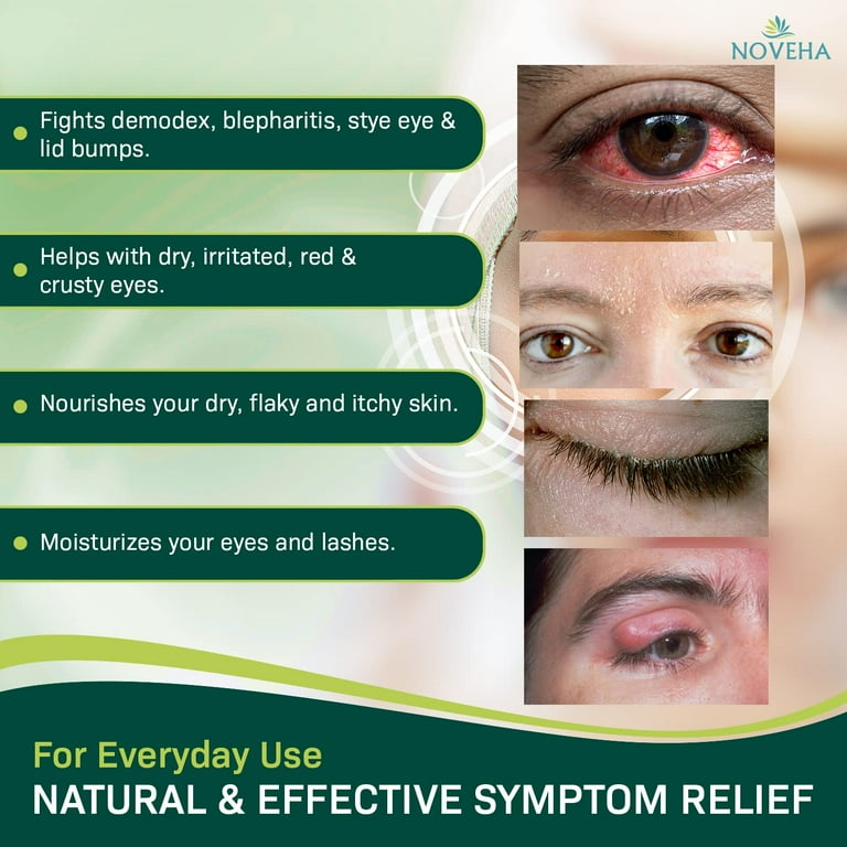 Demodex Eyelid Cleanser Foam | Extra Strength Tea Tree Oil Formula 