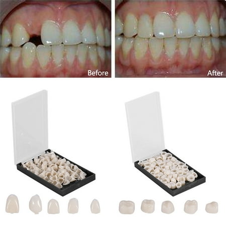 Temporary Dental Crown Back Teeth,Temporary Realistic Oral Care Resin Crown Teeth,50Pcs/Box
