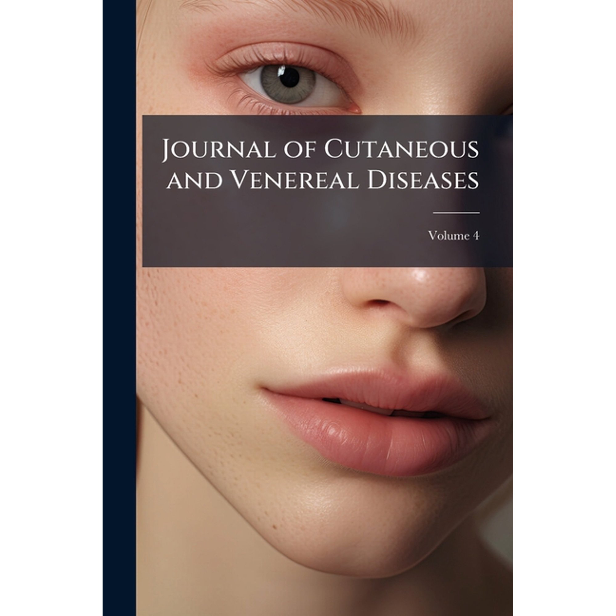 Journal of Cutaneous and Venereal Diseases, Volume 4
