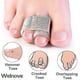 thumbnail image 3 of 6-pack Of Hammer Toe Straighteners For Straightening Hammer Toes, Broken Toes, Crooked Toes And Overlapping Toes, 3 of 3