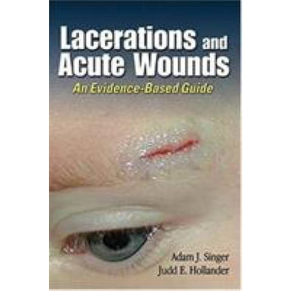 Pre-Owned Lacerations and Acute Wounds: An Evidence-Based Guide (Paperback) 080360775X 9780803607750