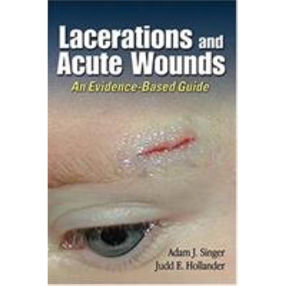 Pre-Owned Lacerations and Acute Wounds: An Evidence-Based Guide (Paperback) 080360775X 9780803607750