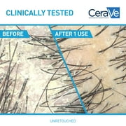 CeraVe Hydrating Anti-Dandruff 2in1 Shampoo & Conditioner for Flakey Itchy Scalp, 12 fl oz