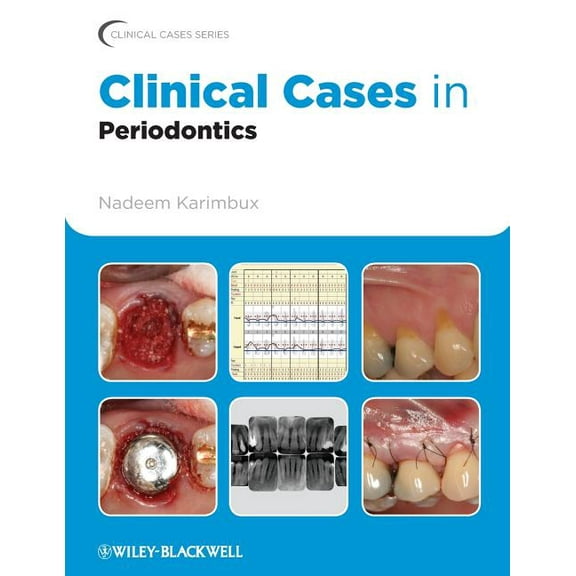 Clinical Cases (Dentistry) Clinical Cases in Periodontics, Book 42, (Paperback)