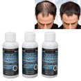 thumbnail image 4 of Suero Para El Crecimiento Del Cabello Para Hombres, 3 X 60 Ml, Previene La Caída Del Cabello, Fácil De Absorber, Líquido Seguro Para El Crecimiento Del Cabello Para Cabello, 4 of 7