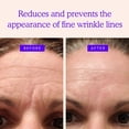 thumbnail image 2 of Parches antiarrugas BLUMBODY para rostro y frente, suministro para 30 días, 2 of 7
