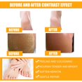 thumbnail image 2 of Foot Peeling Spray Aceite esencial de naranja Exfoliante Peel Removedor de piel muerta Ygjytge Cuidado Belleza, 2 of 9