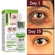 thumbnail image 1 of Crema para ojos de rápida reducción, reduce bolsas, patas de gallo, líneas finas y flacidez. Resultados en tan solo 6 semanas (20 ml/0,68 fl oz)., 1 of 9