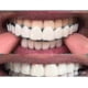 thumbnail image 3 of Prótesis flexibles de ajuste cómodo superior/inferior, dientes superiores, 3 of 4