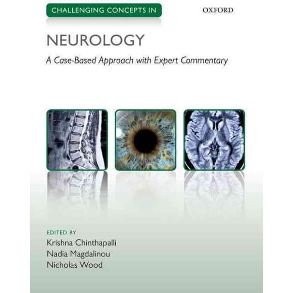 Concepts Difficiles en Neurologie, Bois de Nicholas, Krishna Chinthalli, et al. Broché
