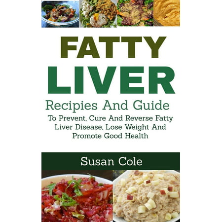Fatty Liver: Recipes and Guide to Prevent, Cure and Reverse Fatty Liver Disease, Lose Weight and Promote Good Health - (Best Cure For Fatty Liver)