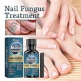 thumbnail image 1 of Nail Fungus Treatment for Toenails, Toenail Fungus Treatment, Extra Strength Nail Fungus Treatment For Fingers & Toenai, 1 of 5