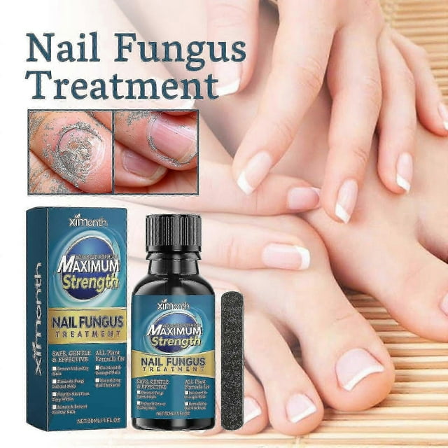 Nail Fungus Treatment for Toenails, Toenail Fungus Treatment, Extra Strength Nail Fungus Treatment For Fingers & Toenai