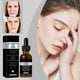 thumbnail image 5 of Fiudx Ofertas del día Esencia facial con ácido hialurónico Aclara las arrugas Tensa las arrugas Hidrata Ilumina Hidrata Alivia las arrugas 30 ml, 5 of 7