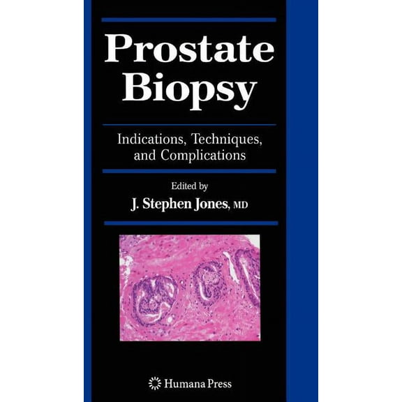 Current Clinical Urology Prostate Biopsy: Indications, Techniques, and Complications, (Hardcover)
