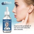 thumbnail image 2 of Tinnitus Relief Solution For Inner Ear Obstruction Tinnitus On The Back Of The Ear And Discomfort In The Ear Cochlea, 2 of 4