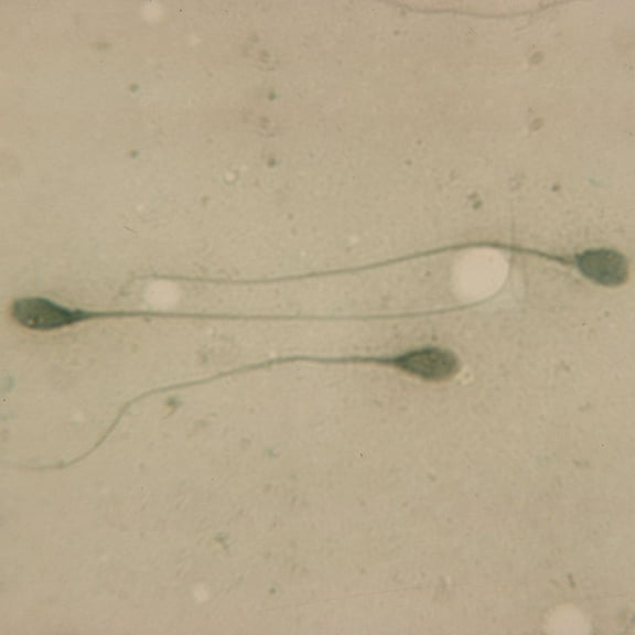 Human Sperm Prepared Microcope Slide, Smear
